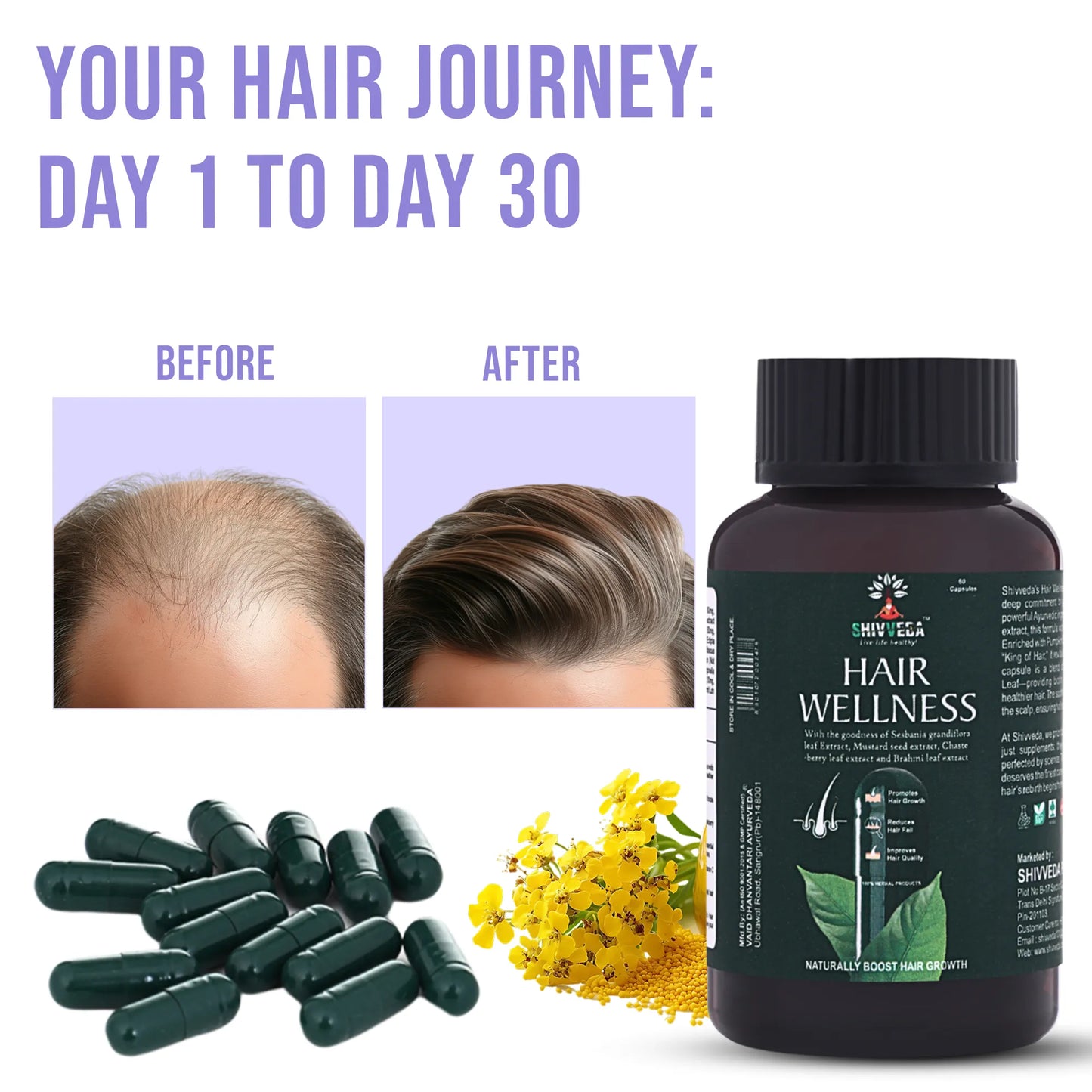 Shivveda Hair Wellness – Natural Hair Growth and Care Supplement